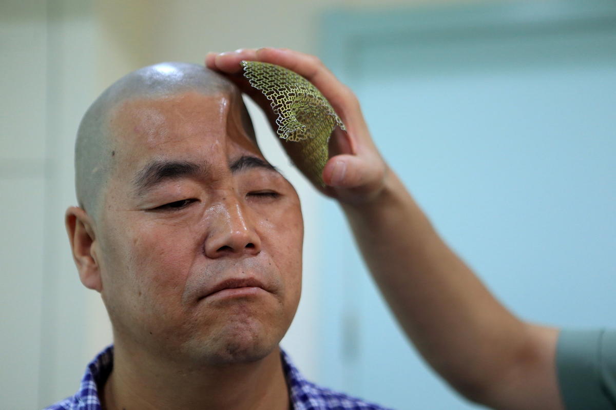 未來醫療行業 3D打印技術融入其中的四種方式

3D醫療行業,3D打印心臟,3D打印大腦,3D打印應用,3D打印領域,3D打印和醫療的關系,3D打印平臺,3D打印服務,3d打印企業服務平臺
