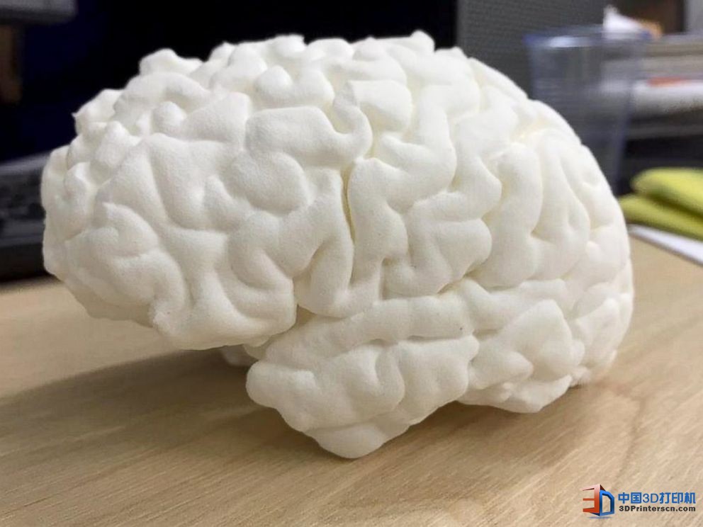 未來醫療行業 3D打印技術融入其中的四種方式

3D醫療行業,3D打印心臟,3D打印大腦,3D打印應用,3D打印領域,3D打印和醫療的關系,3D打印平臺,3D打印服務,3d打印企業服務平臺